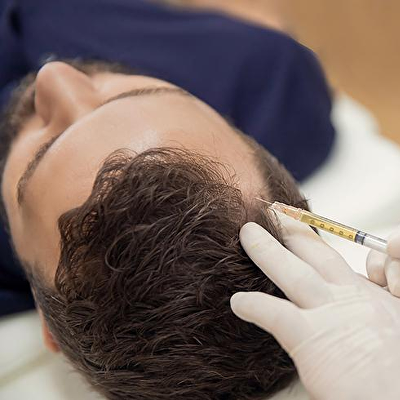 FUEplus uitgelegd: de precisie van de FUEplus techniek