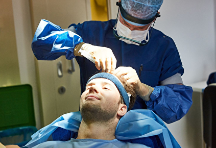 Uitleg over haartransplantatie