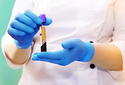 Scheiding van het plasma