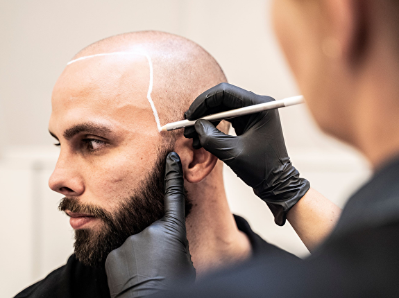 Hoe werkt haarpigmentatie?