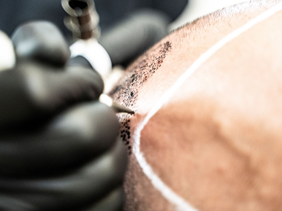 Minuscule puntjes pigment