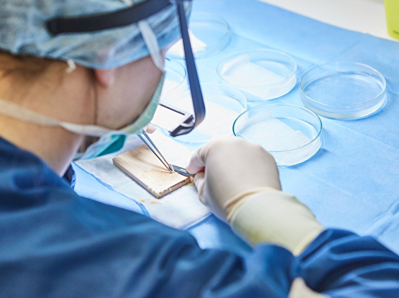 Levenslange garantie haartransplantatie