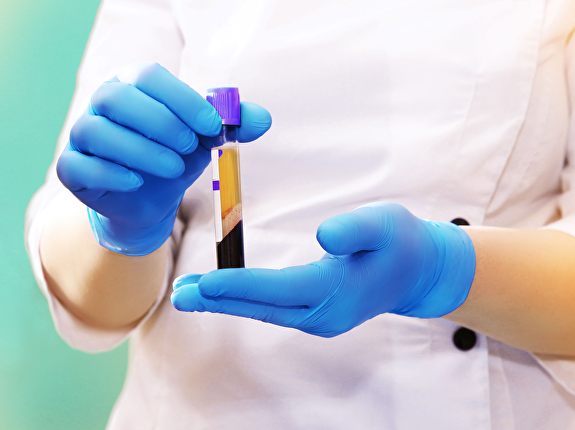 Voor wie is haarverbetering geschikt?