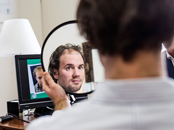 Wat kost een haartransplantatie?