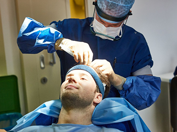 FUE Haartransplantatie