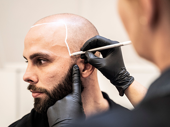 6. Is scheren nodig voor de behandeling?