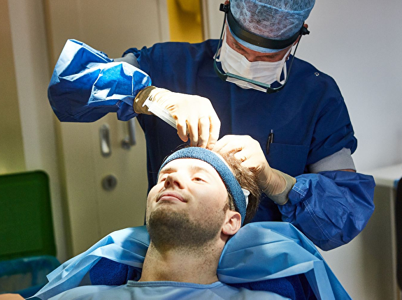 Voordelige haartransplantatie last-minute