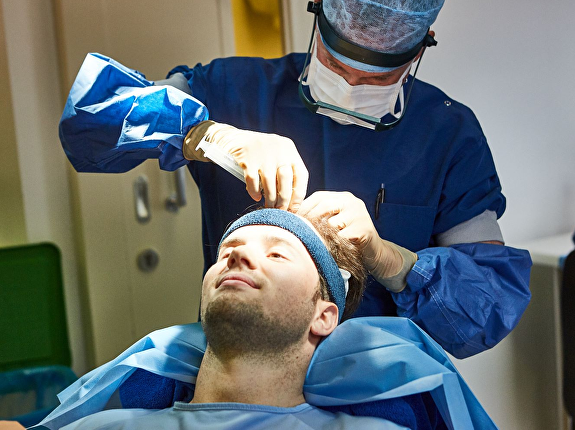 Hoe werkt haarimplantatie?