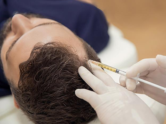 Voor- en nadelen FUT-haarimplantatie
