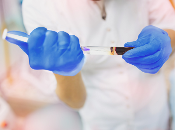 Haarverbetering met PRP