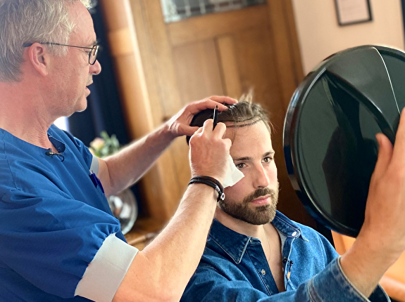 Alles over haartransplantatie