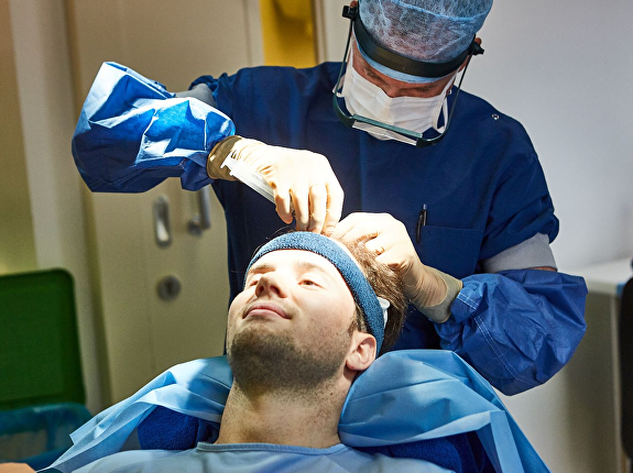 Haartransplantatie tijdsduur