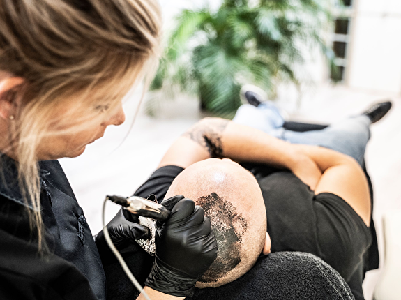 Micro haarpigmentatie bij Transhair