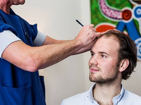 Excellente FUE haartransplantatie bij Transhair