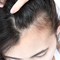 Transhair: Whitepaper Haarverbetering