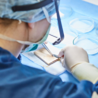 Transhair: Whitepaper FUE